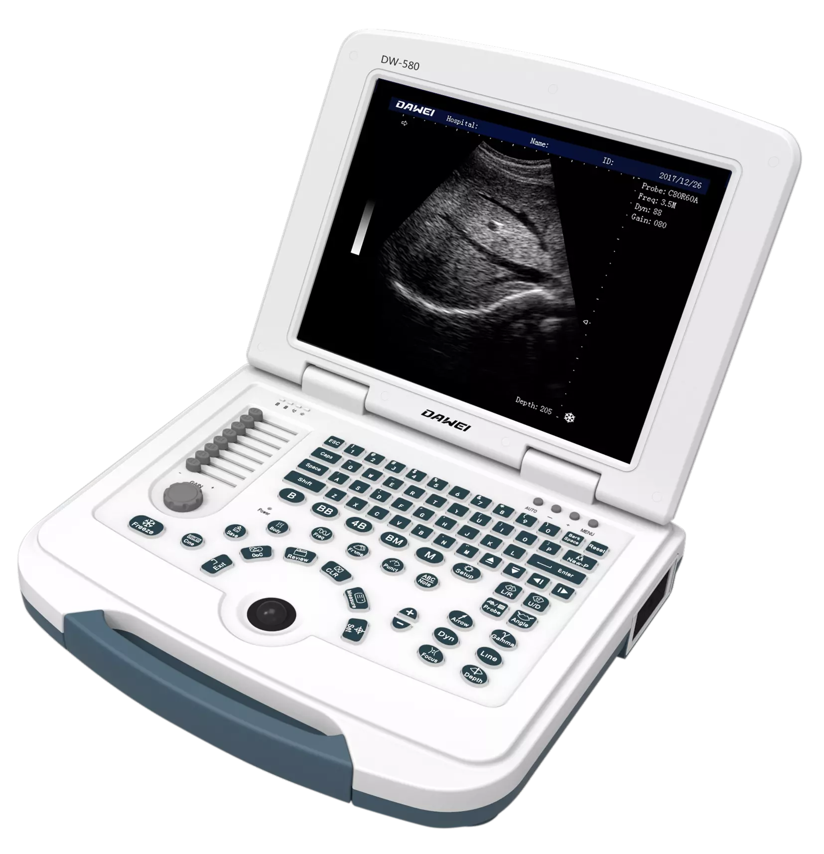 Portable ultrasound machine dw580